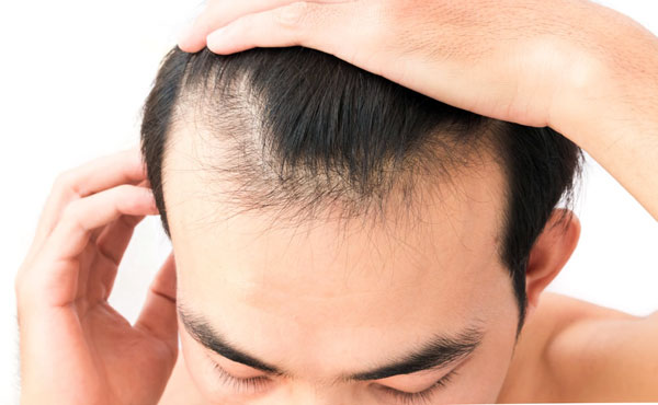 stempiatura capelli